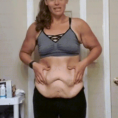 Made in the USA ✨Newly developed Bee Venom Skin Repair Cream⏰ Last day 80% off 💕