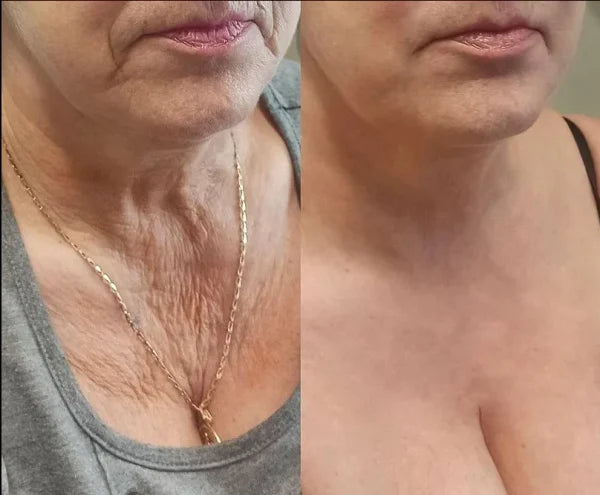 Made in the USA ✨Newly developed Bee Venom Skin Repair Cream⏰ Last day 80% off 💕