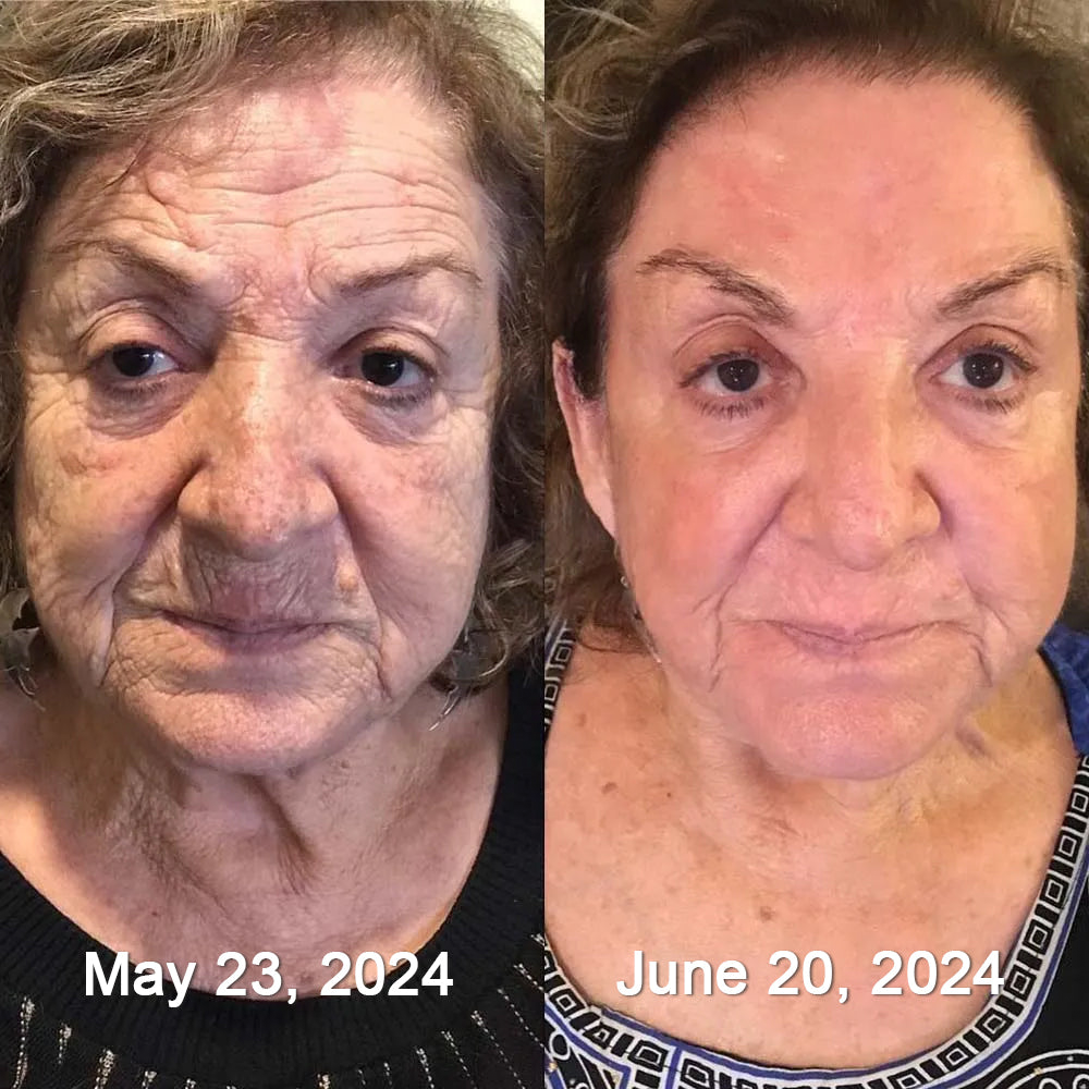 Made in the USA ✨Newly developed Bee Venom Skin Repair Cream⏰ Last day 80% off 💕（副本）