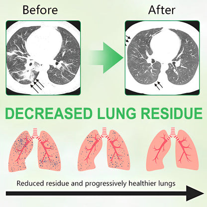 🌿SouthMoon® 3X Concentrated Mullein Lung Cleanse Spray — Advanced Respiratory Detox & Clear Breathing