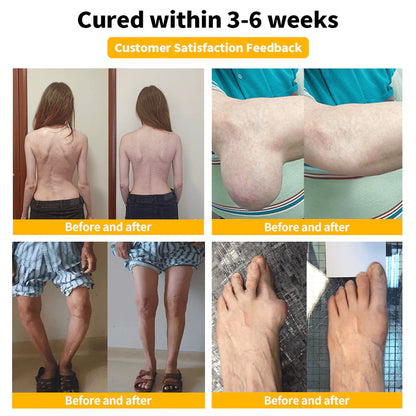 🔥 South Moon BEE VENOM PAIN RELIEF CREAM | RAPID JOINT & BONE RECOVERY 🦵🐝