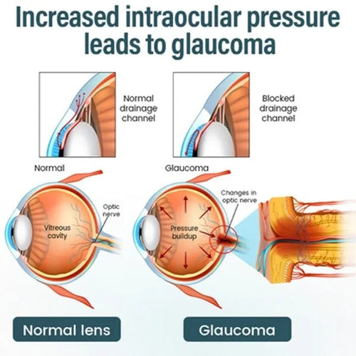 Reclaim Your Crystal-Clear Vision With NANO Eye EELHOE® Drops