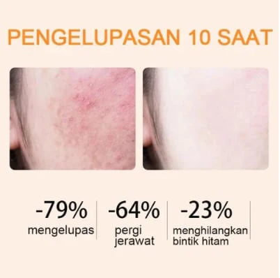 🔥Orange Enzyme Exfoliating Gel- The Gentle Miracle Your Skin Has Been Crying Out For