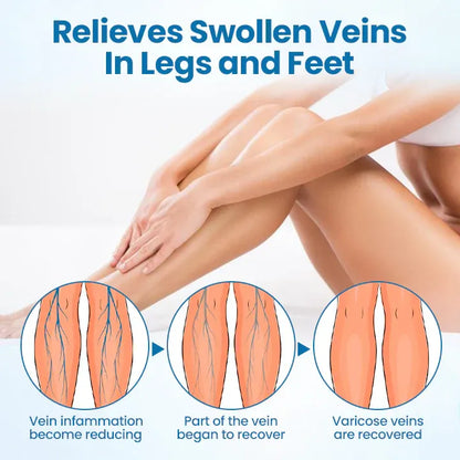 SouthMoon Herbal Spray-✅ Clinically proven to eliminate varicose veins in just 7 days!
