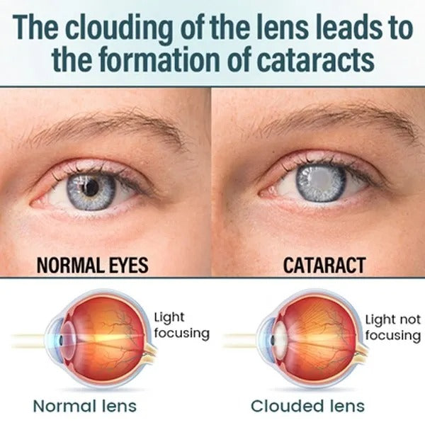 Reclaim Your Crystal-Clear Vision With NANO Eye EELHOE® Drops