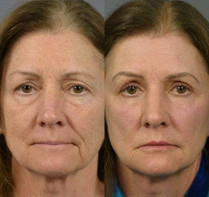 ⚡ Instant Face Lift Primer – Smooth, Tighten & Glow! FREE Brush Gift!